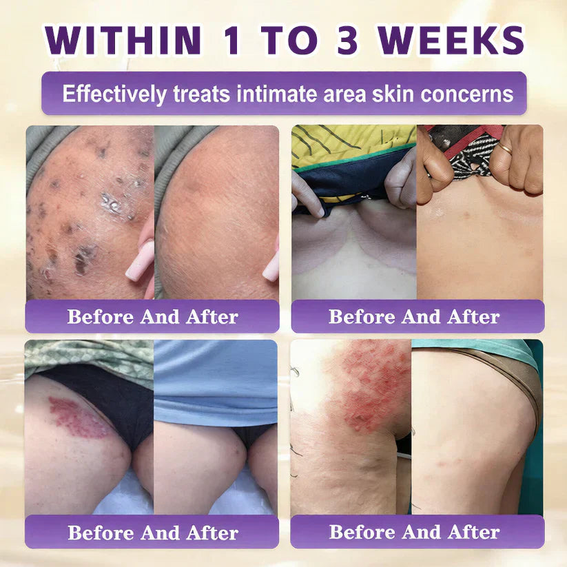 Windolix® Biotin 10-in-1 Skin Restoration Cream