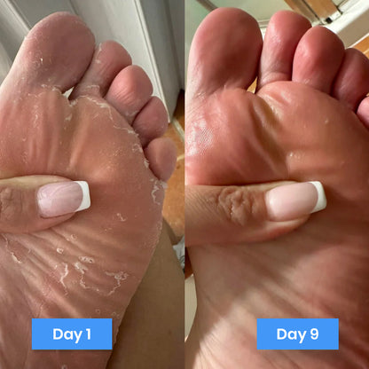new aura® antifungal repair cream