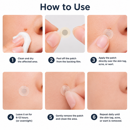 ✨Elmstr®2-in-1 Microneedle & Hydrocolloid Patch🍀| Removes Raised Moles, Acne, Flat Warts & Skin Tags | Helps Improve Wrinkles, Scars & Blemishes | Invisible Patches for Face & Body