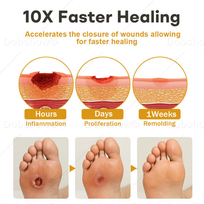 (🔥Last Day Promotion)🔥Healrize®GlucoShield Bee Venom Wound Spray💪