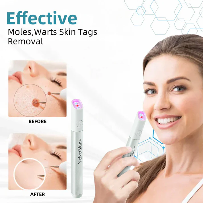 Xalnora™ All-in-One CO₂ Laser Eraser Pen | Removes Moles, Warts, Skin Flaws & Pigmentation