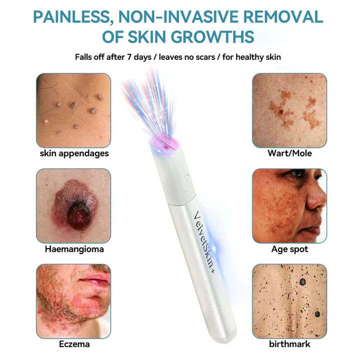 Xalnora™ All-in-One CO₂ Laser Eraser Pen | Removes Moles, Warts, Skin Flaws & Pigmentation