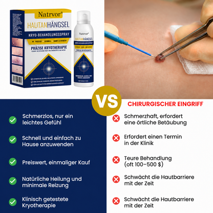 Natrvor® Skin Tag Cryo-Treatment Spray: Fast removal of warts & calluses – visible results in 7 days ✨