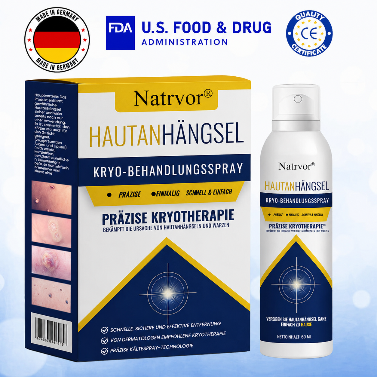 Natrvor® Skin Tag Cryo-Treatment Spray: Fast removal of warts & calluses – visible results in 7 days ✨
