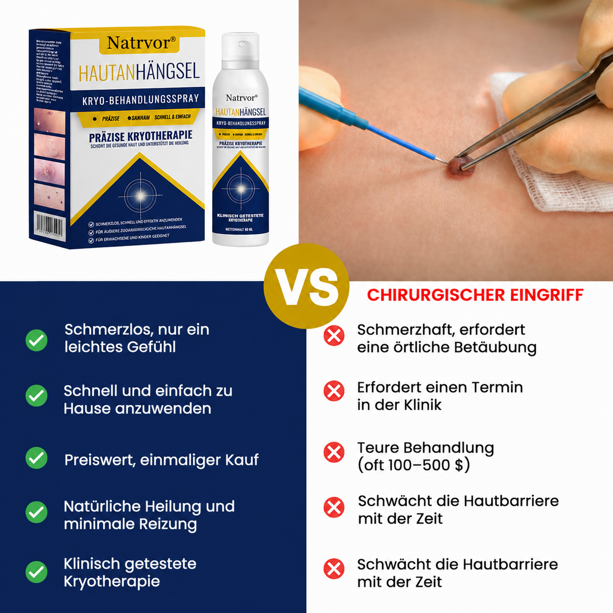 Natrvor® Skin Tag Cryo-Treatment Spray: Fast removal of warts & calluses – visible results in 7 days ✨