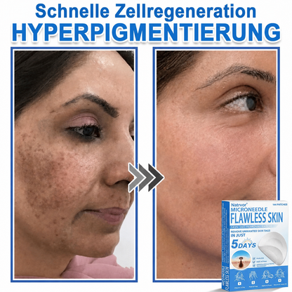Natrvor® Microdart Hydrogel Patches