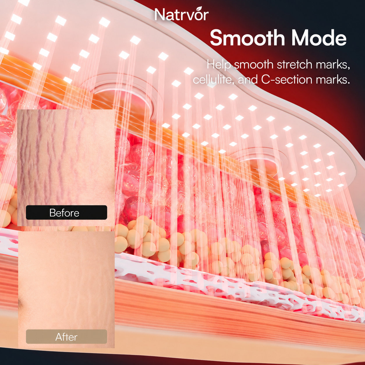 Natrvor® PULSE Red Light EMS Core Belt