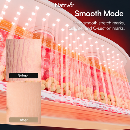 Natrvor® PULSE Red Light EMS Core Belt