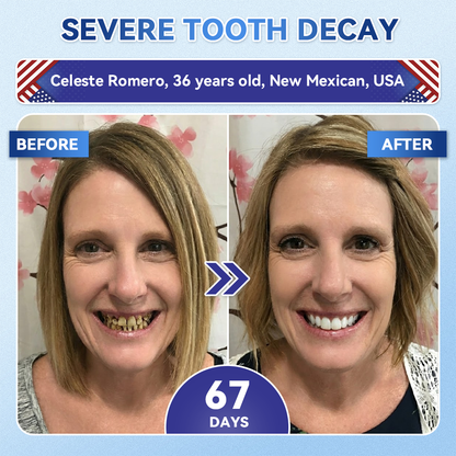 Alvetra® Fast-Dissolving Tooth & Gum Care Strips 5-in-1 Daily Care for a Cleaner, Brighter, Healthier Smile