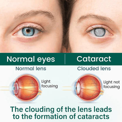 NATRAVOR OptiClear Nano Eye Roller Serum