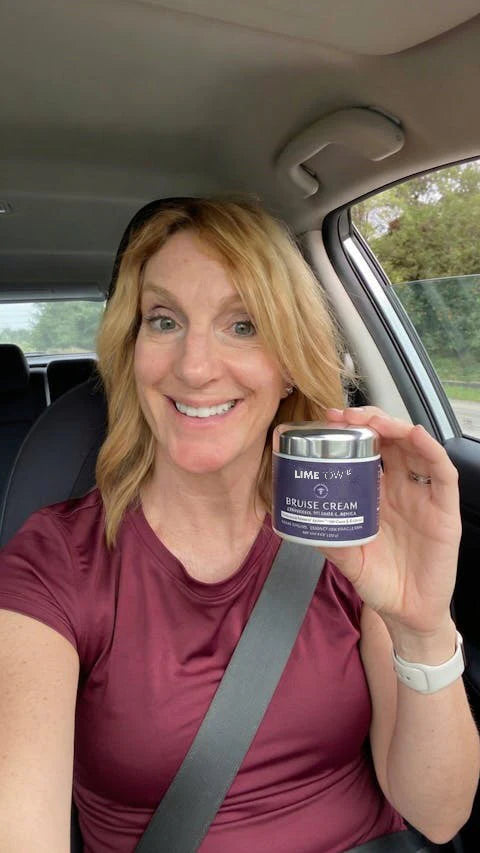 Alice holding bruise cream