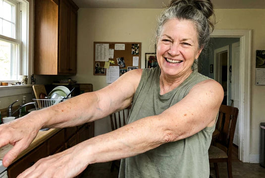 Elizabeth showing her arms