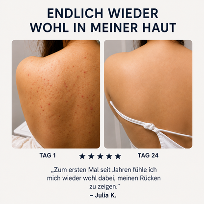 Zanari Rückenseife gegen Akne
