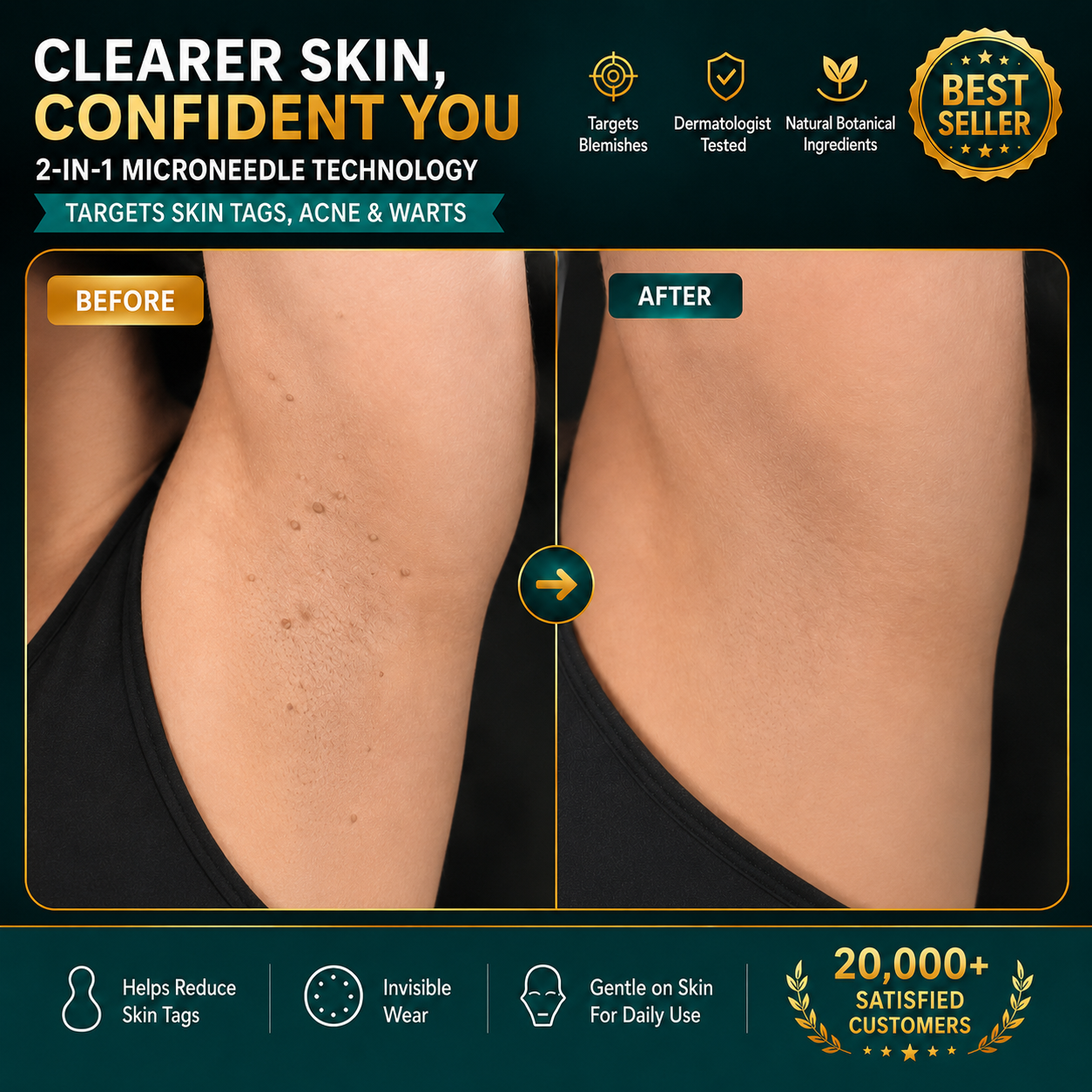 ✨Tenviro®2-in-1 Microneedle & Hydrocolloid Patch🍀| Removes Raised Moles, Acne, Flat Warts & Skin Tags | Helps Improve Wrinkles, Scars & Blemishes | Invisible Patches for Face & Body