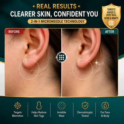 ✨Tenviro®2-in-1 Microneedle & Hydrocolloid Patch🍀| Removes Raised Moles, Acne, Flat Warts & Skin Tags | Helps Improve Wrinkles, Scars & Blemishes | Invisible Patches for Face & Body