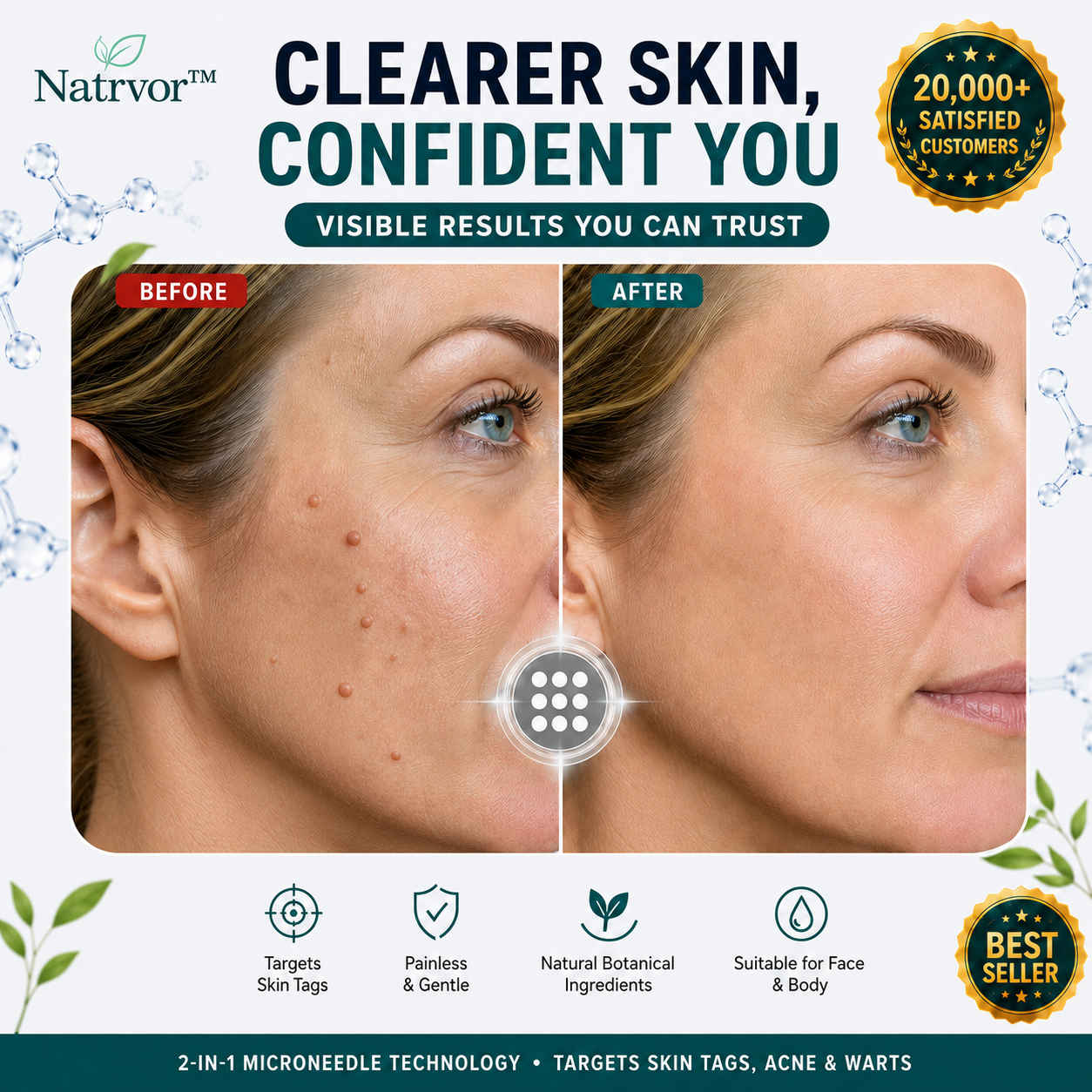 ✨Tenviro®2-in-1 Microneedle & Hydrocolloid Patch🍀| Removes Raised Moles, Acne, Flat Warts & Skin Tags | Helps Improve Wrinkles, Scars & Blemishes | Invisible Patches for Face & Body