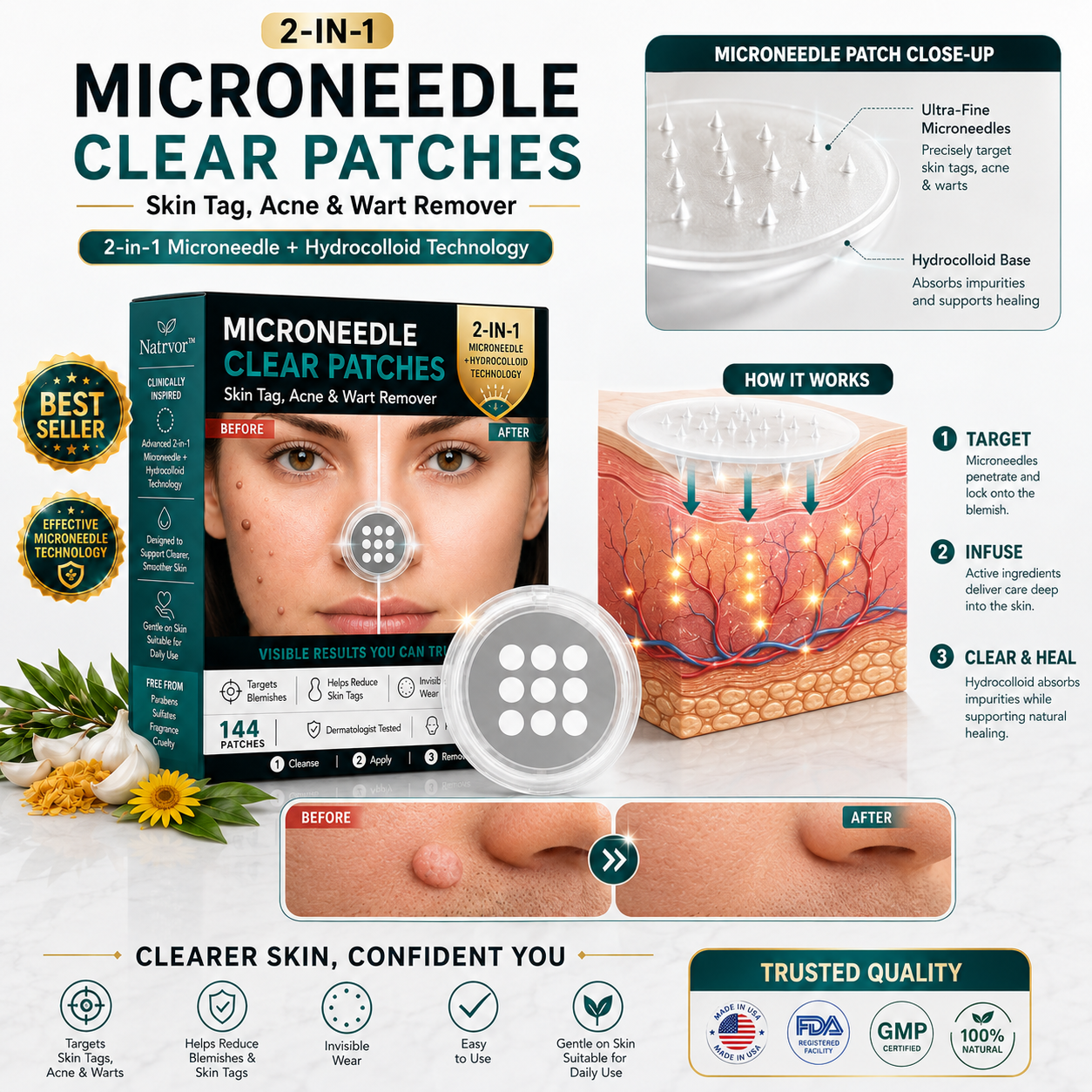 ✨Tenviro®2-in-1 Microneedle & Hydrocolloid Patch🍀| Removes Raised Moles, Acne, Flat Warts & Skin Tags | Helps Improve Wrinkles, Scars & Blemishes | Invisible Patches for Face & Body