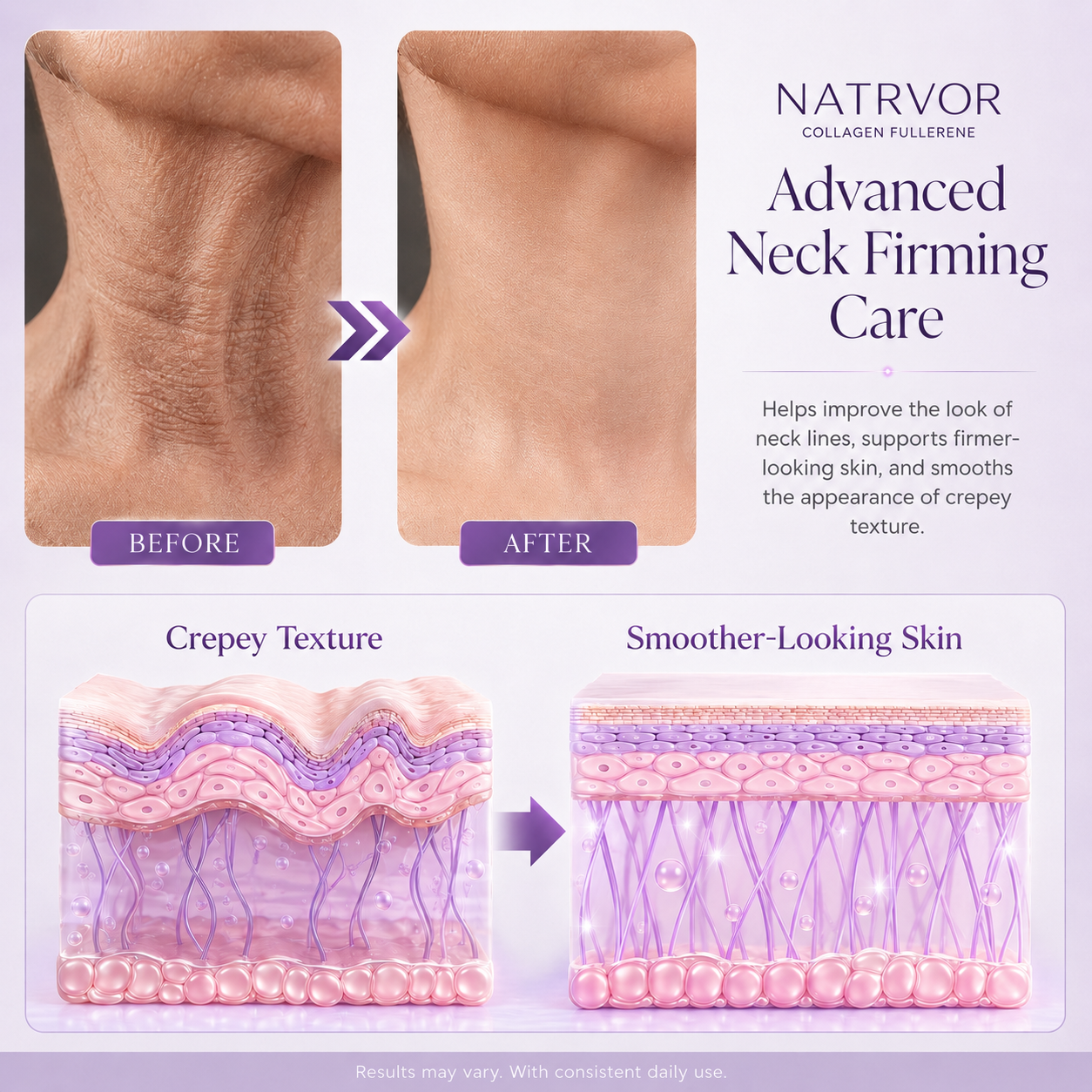 🧠👩‍🔬 NATRVOR All-Over Firming Cream – FDA-Compliant Formula For Face, Neck & Body – Smooth, Tighten & Brighten – 70% OFF + 🎁 Free Derma Roller Today
