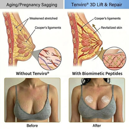 🔥Limited-time 60% sale--Tenviro Targeted Breast Enhancement Advanced Nano-Microneedle Patches