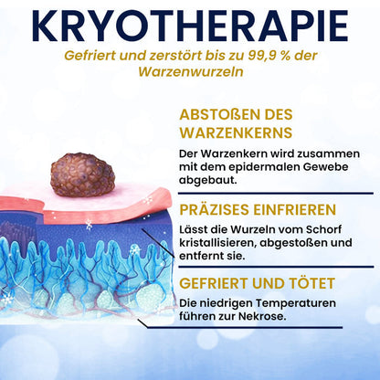 AEXZR® Hautanhängsel Kryo-Behandlungsspray Spray: Schnelle Entfernung von Warzen & Hornhaut – 7 Tage sichtbare Ergebnisse ✨